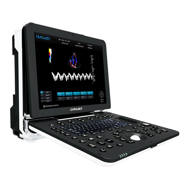 doppler portable ultrasound