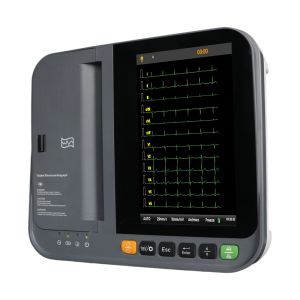 Electrocardiogram