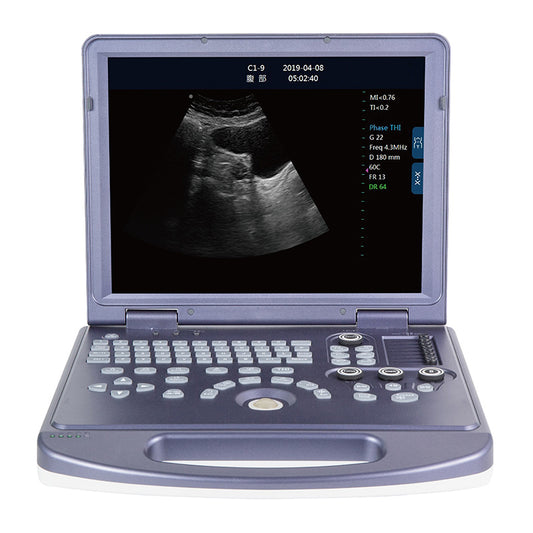 DW-360 laptop black and white ultrasound machine